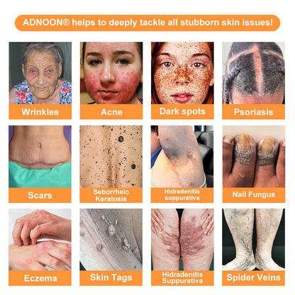 ADNOON® 🌐 7-Day Multi-Effect All-in-One Skincare Cream—Professionally Supported by AAD 👩🏽‍⚕️
