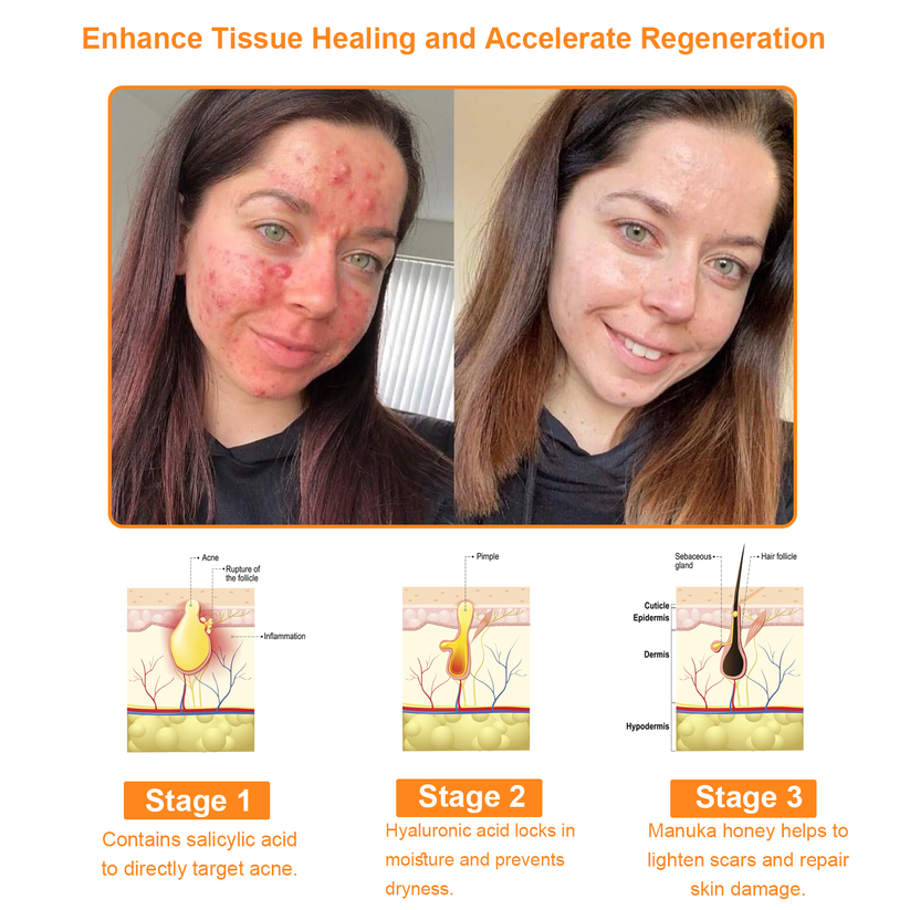 ADNOON® 🌐 7-Day Multi-Effect All-in-One Skincare Cream—Professionally Supported by AAD 👩🏽‍⚕️
