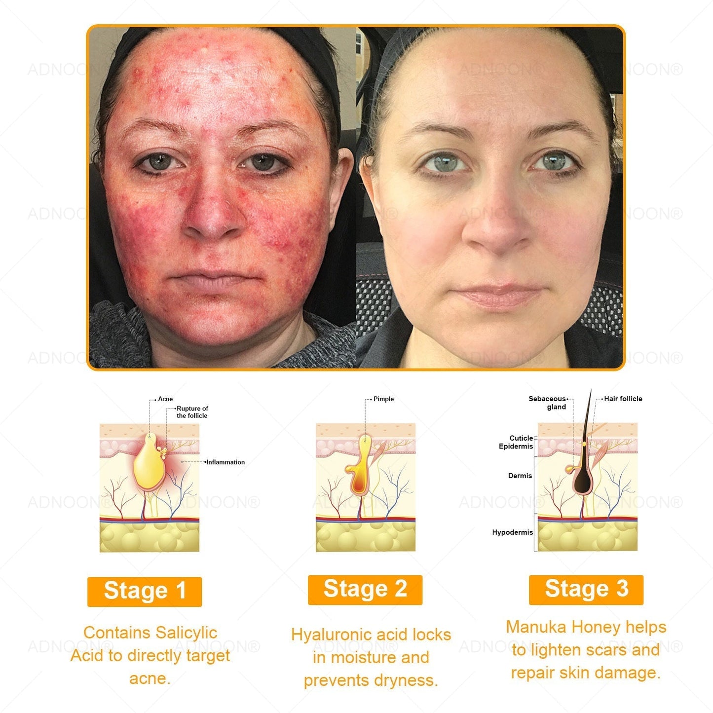 ADNOON® 🌼 7-Day Multi-Effect All-in-One Skincare Cream—Professionally Supported by AAD 👨‍⚕️