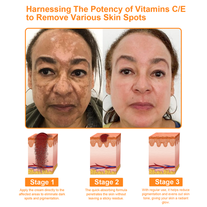 ADNOON® 🌐 7-Day Multi-Effect All-in-One Skincare Cream—Professionally Supported by AAD 👩🏽‍⚕️